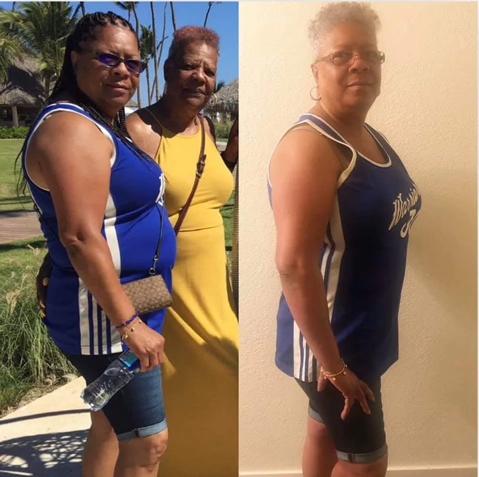 Barbara before and after: the same blue and white tank, slimmer in the after photo